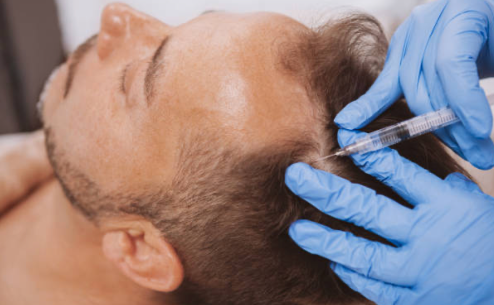 PRP (Platelet Rich Plasma)