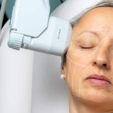 HIFU (High Intensity Focused UltraSound)